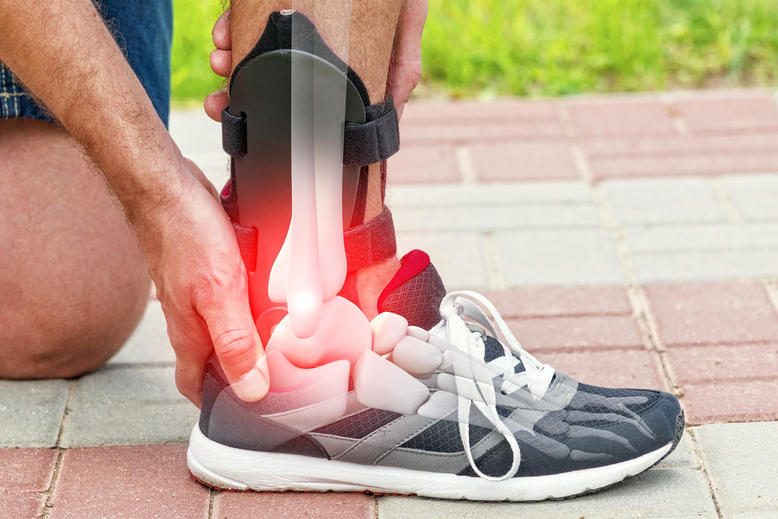La tobillera ayuda a prevenir esguinces ¿Para qué sirve una tobillera?