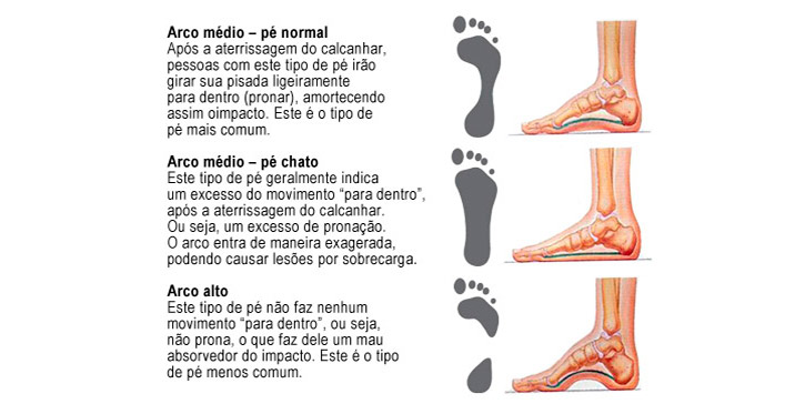 Tipos de arcos del pie